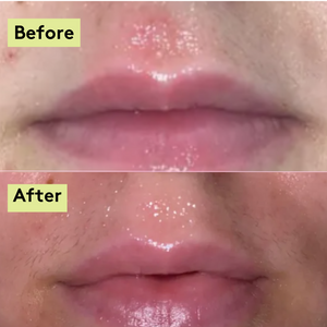 Sensitive Skin Balm Duo