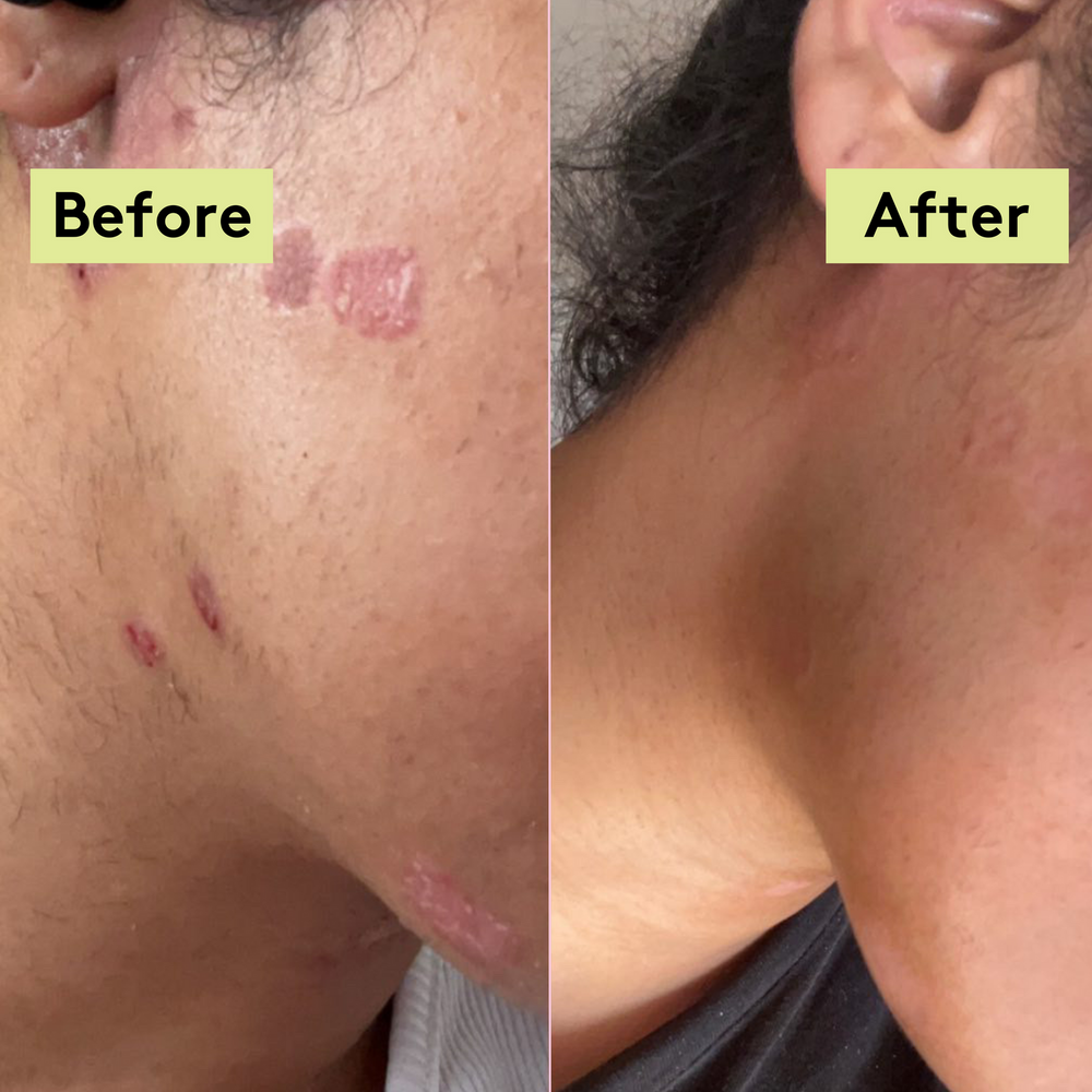 Migh-Tea Moisture Multipurpose Balm - Fragrance Free