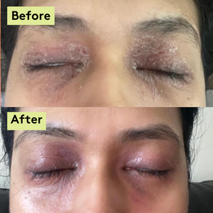 Sensitive Skin & Scalp Bundle