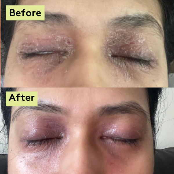 Sensitive Skin & Scalp Bundle