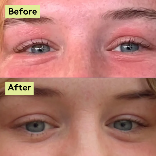 Sensitive Skin Balm Duo