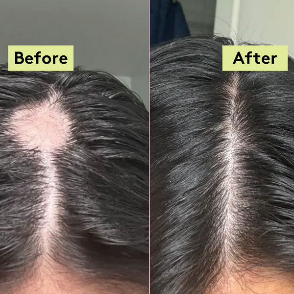 Rich Roots Hair & Scalp Oil