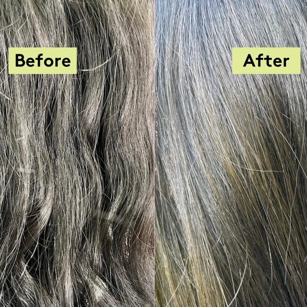 Hair & Scalp Saviour Set