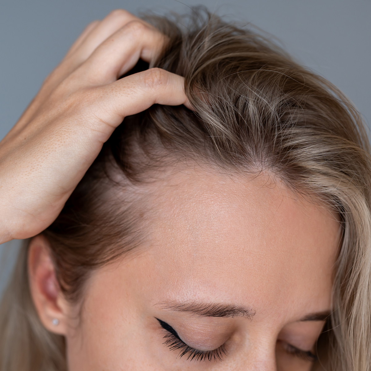 Dry, Itchy, Sensitive Scalp? How to Choose Natural Hair Care That Actually Soothes