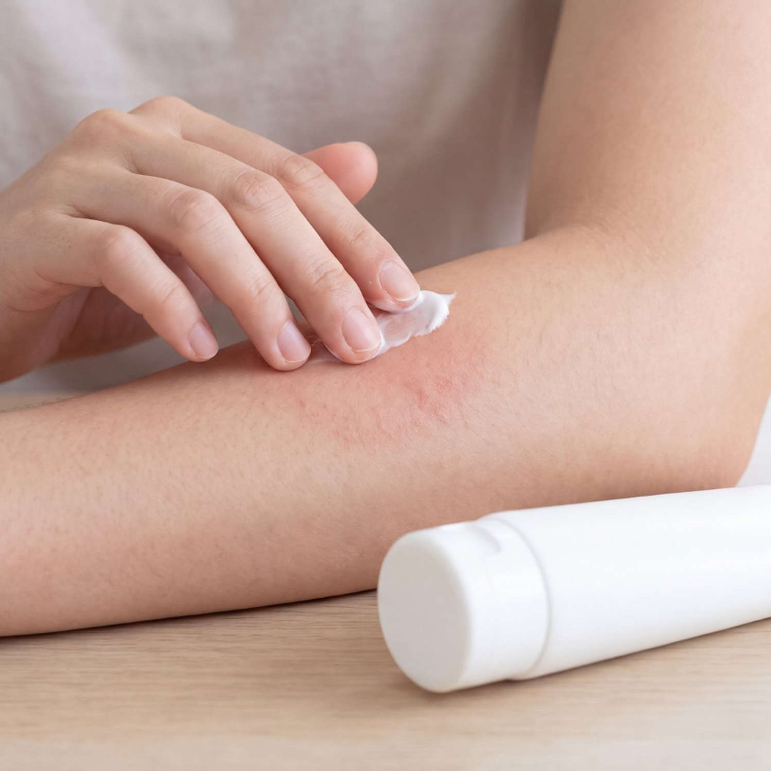  Eczema Daily Control Kit