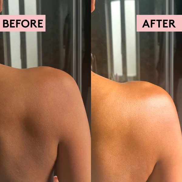 Migh-Tea Moisture Dry Skin Recovery Kit