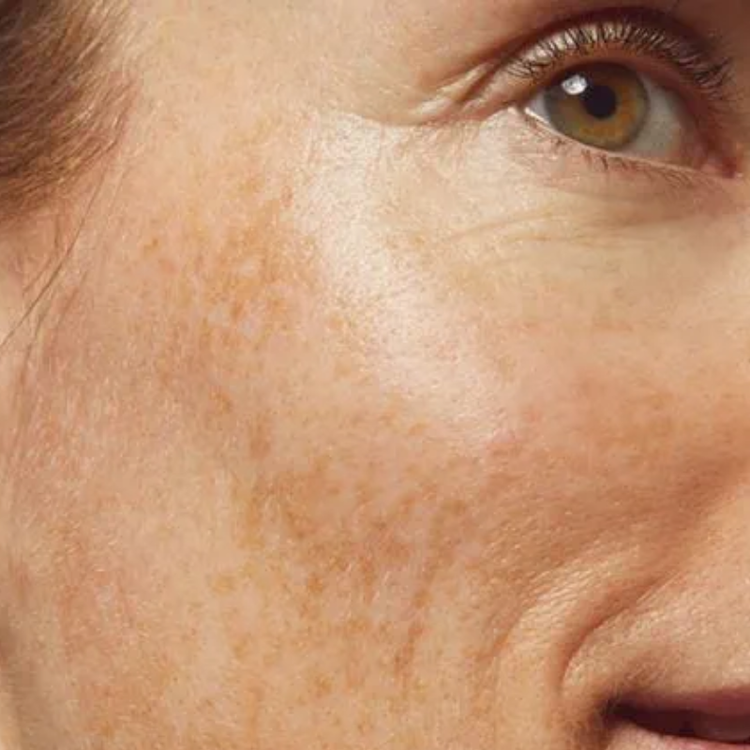 Natural Skin Care Products & Scalp Oil Treatment | Delhicious Body