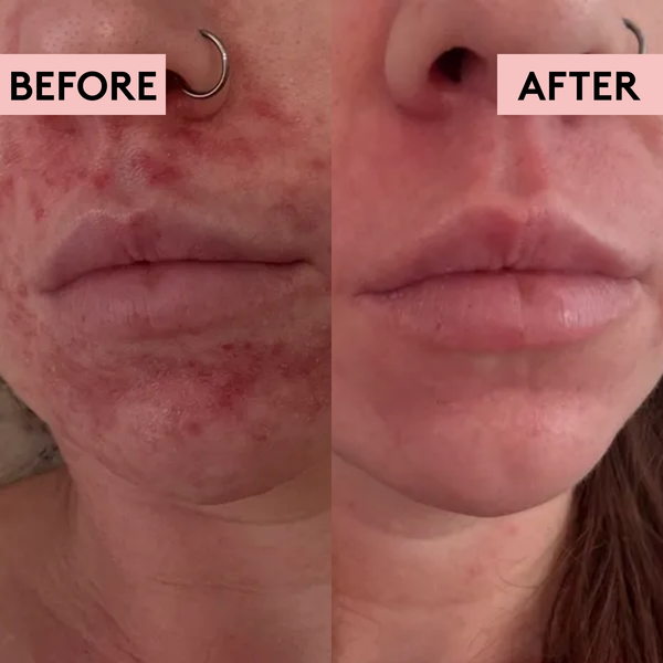 Migh-Tea Moisture Multipurpose Balm - Original