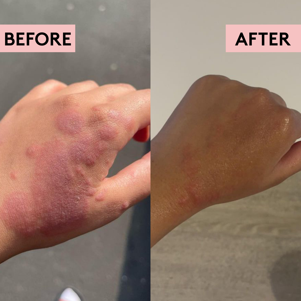 Migh-Tea Moisture Skin Recovery Balm