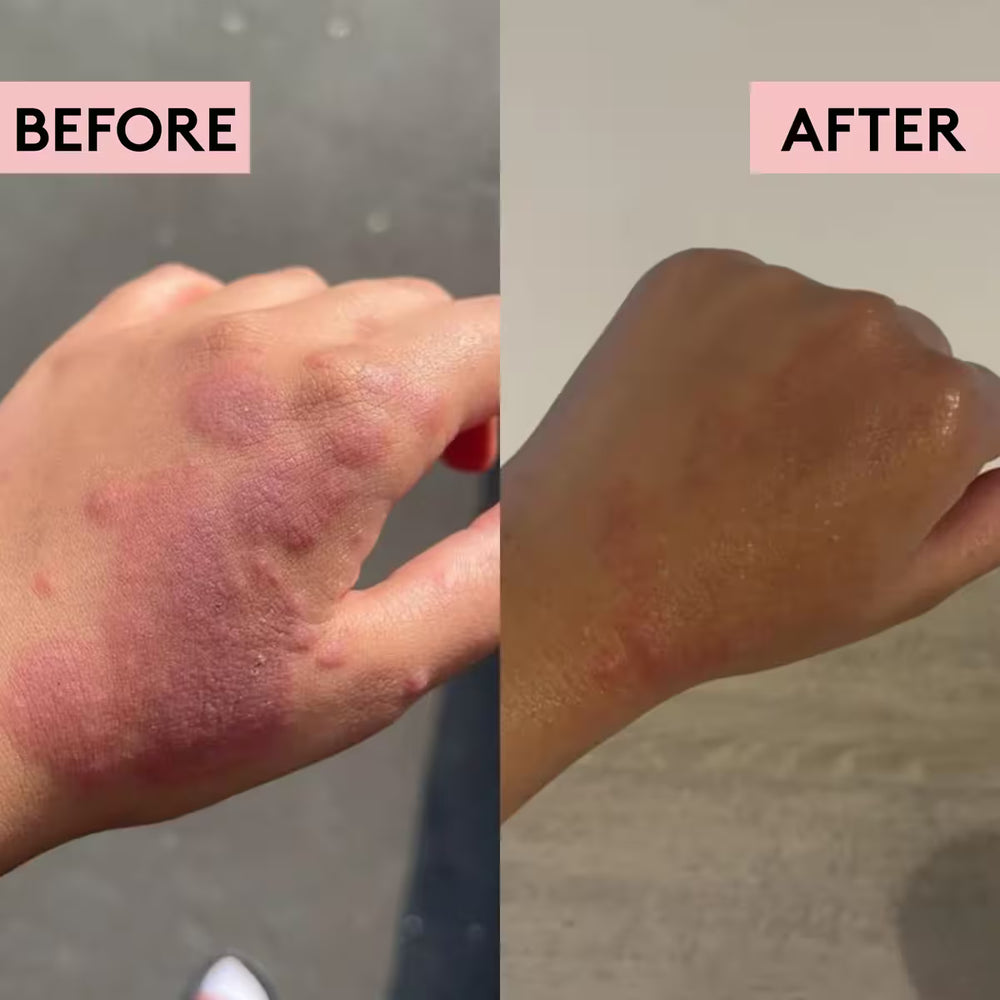Migh-Tea Moisture Skin Recovery Balm