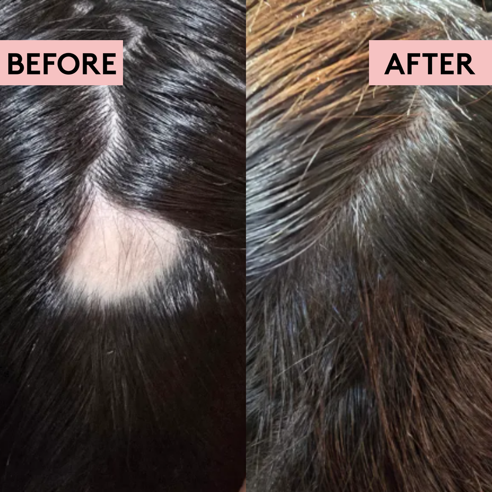Rich Roots Hair & Scalp Growth Oil