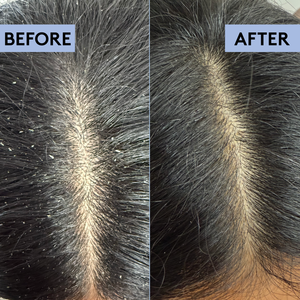 Scalp-Eaze Scalp Scrub