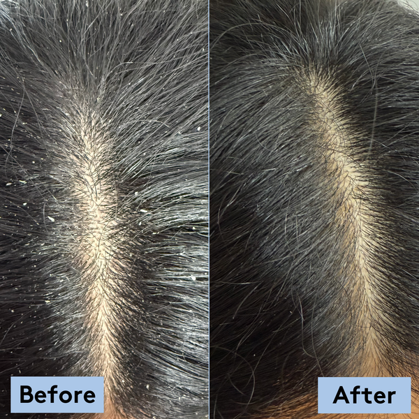 Hair & Scalp Reset Bundle